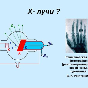 Как генерируются рентгеновские лучи?